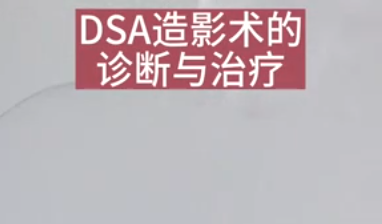 DSA造影術(shù)的診斷與治療